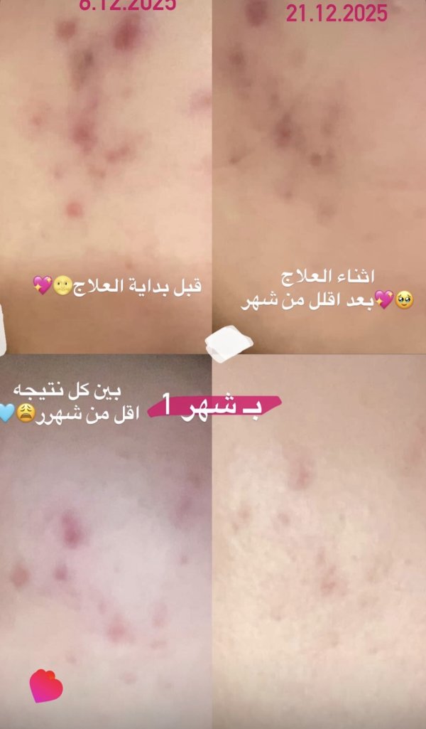 بنوتة من طولكرم